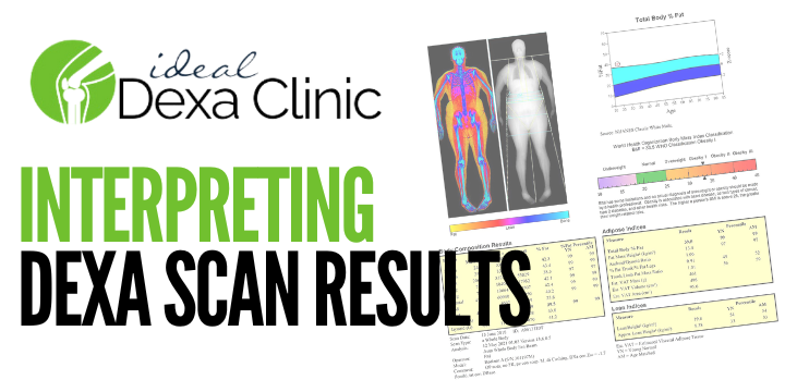 Interpreting DEXA Scan Results: A Comprehensive Guide