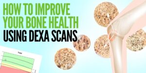 How to Improve Your Bone Health Using DEXA Scans