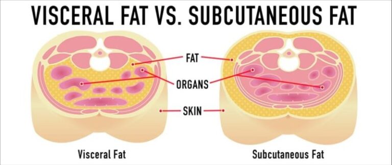 Visceral Fat: Health Risks, How to Measure It, and How to Reduce It ...
