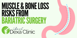 Muscle & Bone Loss Risks After Bariatric Surgery: What You Need to Know