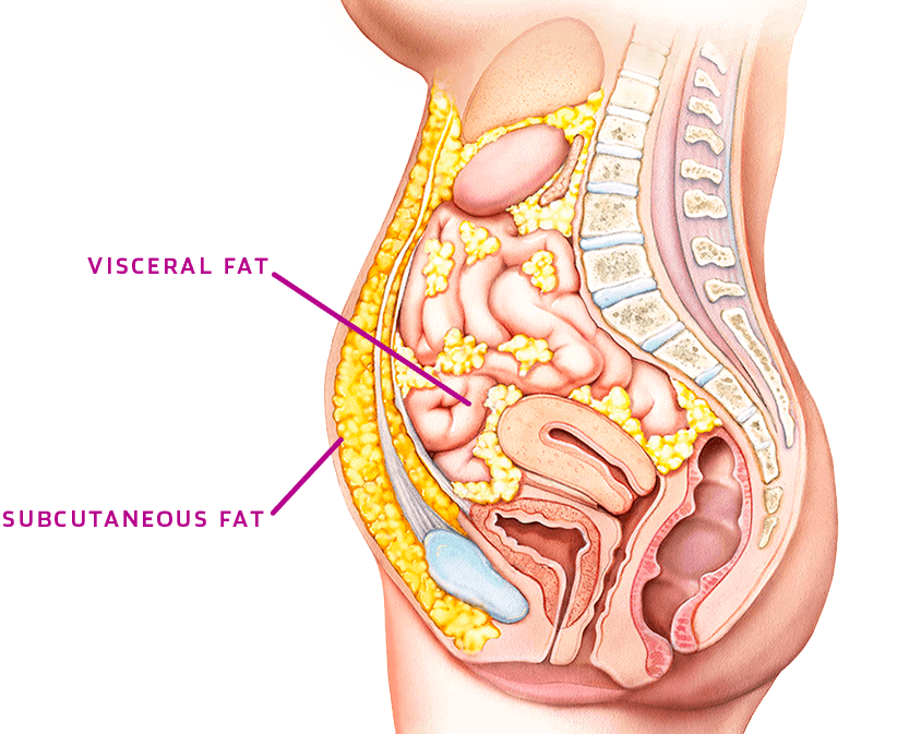 Visceral vs subcutaneous fat location.
